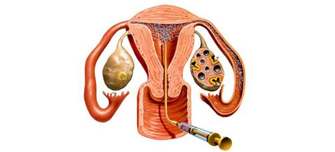 Ayurvedic Treatment for pregnancy in sinhgad road pune
